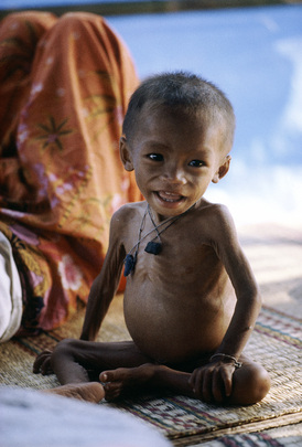 Coping with Disaster: Kampuchean Refugees