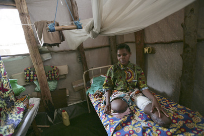 United Nations Mission in DR Congo Helps Mine Accident Wictims