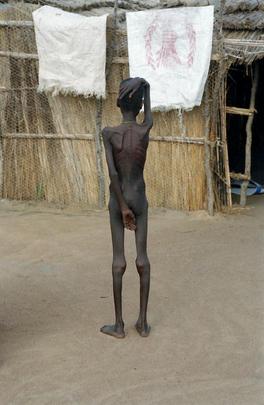 Operation Lifeline Helps Displaced People in Southern Sudan