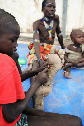 South Sudanese Displaced by Violence Recover at UN Medical Base