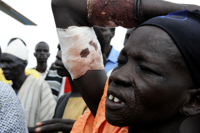 UN Evacuates Wounded in Aftermath of Bombings in South Sudan