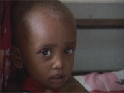 Selected frame from video story 
MADAGASCAR / MALNUTRITION
	