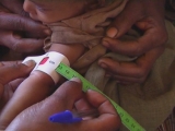 Selected frame from video story 
ETHIOPIA / MALNUTRITION
	