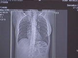 Selected frame from video story 
IAEA / MEDICAL RADIATION
	