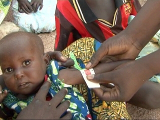 Selected frame from video story 
CAMEROON / MALNUTRITION
	