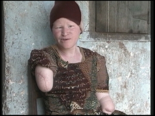 Selected frame from video story 
TANZANIA / ALBINOS
	